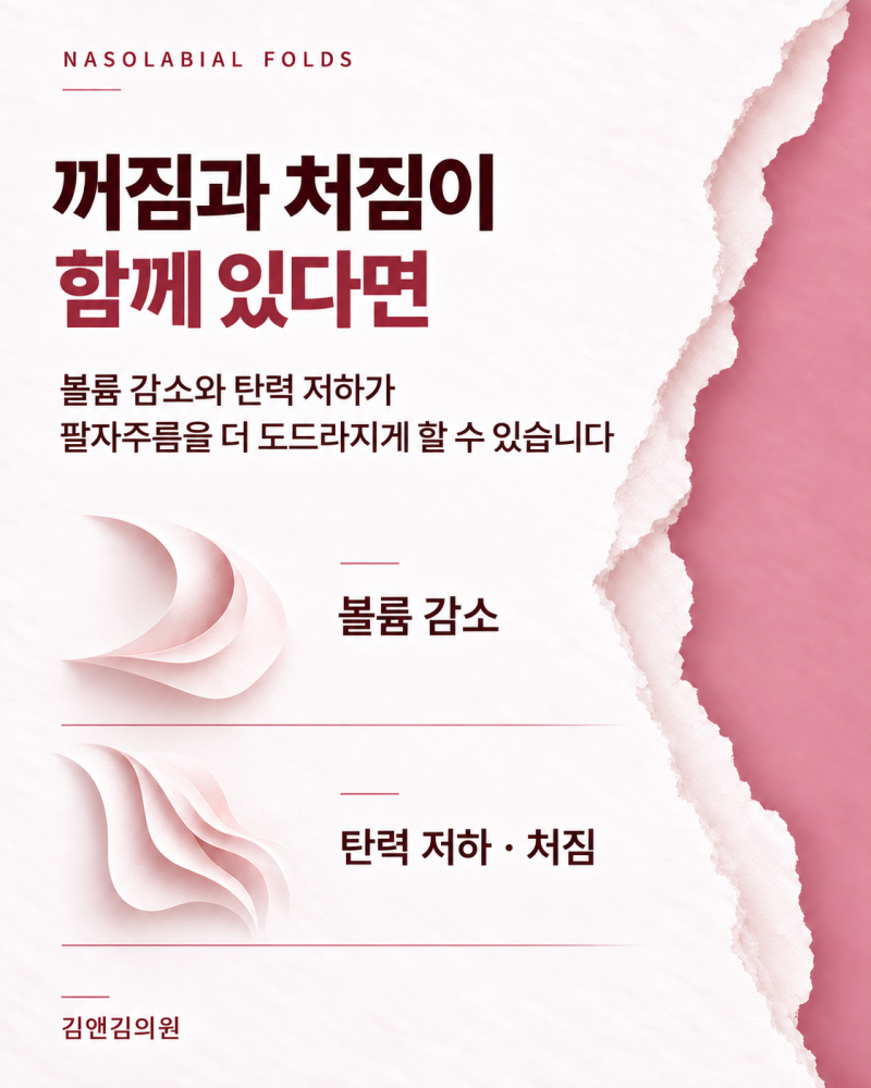 울산팔자주름, 필러와 리프팅을 함께 고려해야 할까요? | 김앤김의원 사진 2